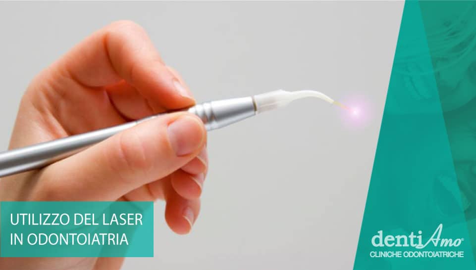 utilizzo-del-laser-in-odontoiatria